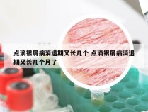 点滴银屑病消退期又长几个 点滴银屑病消退期又长几个月了