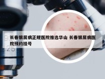 长春银屑病正规医院推选华山 长春银屑病医院预约挂号