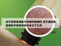 关节型银屑病属于特病和慢病吗 关节病型银屑病关节症状的特点有以下几项