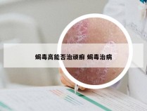 蝎毒高能否治顽癣 蝎毒治病