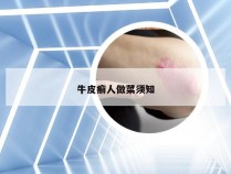 牛皮癣人做菜须知