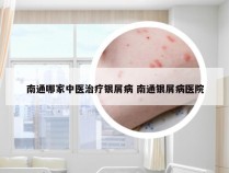 南通哪家中医治疗银屑病 南通银屑病医院