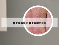 背上长癣图片 背上长癣图片女