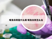 嘴角白斑是什么病 嘴角白斑怎么治