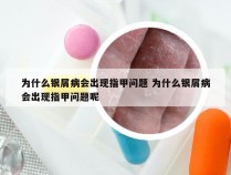为什么银屑病会出现指甲问题 为什么银屑病会出现指甲问题呢