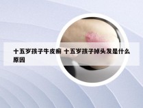 十五岁孩子牛皮癣 十五岁孩子掉头发是什么原因