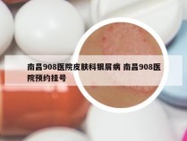 南昌908医院皮肤科银屑病 南昌908医院预约挂号