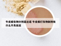牛皮癣生物针剂喜达诺 牛皮癣打生物制剂有什么不良反应