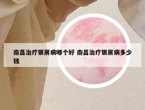 南昌治疗银屑病哪个好 南昌治疗银屑病多少钱