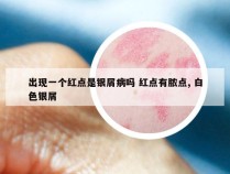 出现一个红点是银屑病吗 红点有脓点, 白色银屑