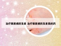 治疗银屑病抗生素 治疗银屑病抗生素类的药