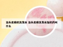 治头皮癣的洗发水 治头皮癣洗发水加的药叫什么