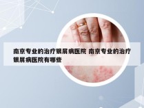 南京专业的治疗银屑病医院 南京专业的治疗银屑病医院有哪些