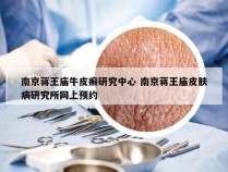 南京蒋王庙牛皮癣研究中心 南京蒋王庙皮肤病研究所网上预约