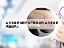 山东省皮肤病医院治疗银屑病吗 山东省皮肤病医院坑人