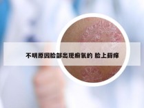 不明原因脸部出现癣氧的 脸上藓痒