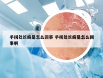 手拐处长癣是怎么回事 手拐处长癣是怎么回事啊