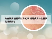头皮银屑病夏季出汗就痒 银屑病为什么夏天出汗就好了