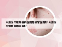 太原治疗银屑病的医院是哪家医院好 太原治疗银屑病哪家最好