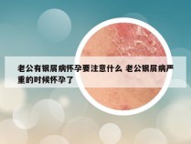 老公有银屑病怀孕要注意什么 老公银屑病严重的时候怀孕了