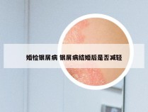 婚检银屑病 银屑病结婚后是否减轻