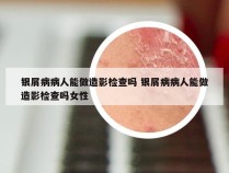 银屑病病人能做造影检查吗 银屑病病人能做造影检查吗女性