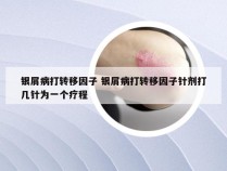 银屑病打转移因子 银屑病打转移因子针剂打几针为一个疗程