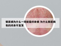 银屑病为什么一得就是终身病 为什么银屑病有的终身不复发