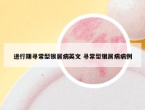 进行期寻常型银屑病英文 寻常型银屑病病例