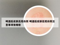 喝酒后皮肤出现白斑 喝酒后皮肤出现白斑注意事项有哪些