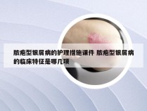 脓疱型银屑病的护理措施课件 脓疱型银屑病的临床特征是哪几项