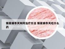 银屑病冬天如何治疗方法 银屑病冬天吃什么药