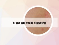 松溜油治疗牛皮癣 松瘤油软膏