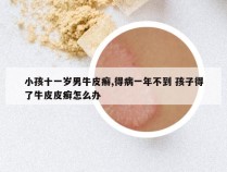 小孩十一岁男牛皮癣,得病一年不到 孩子得了牛皮皮癣怎么办