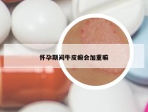 怀孕期间牛皮癣会加重嘛