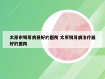 太原市银屑病最好的医院 太原银屑病治疗最好的医院