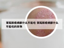 掌跖脓疱病都什么不能吃 掌跖脓疱病都什么不能吃的食物