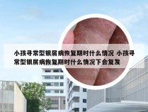 小孩寻常型银屑病恢复期时什么情况 小孩寻常型银屑病恢复期时什么情况下会复发