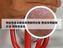 特应性皮炎靶向生物制剂价格 靶向生物制剂疗法 特异性皮炎