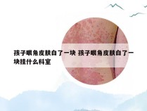 孩子眼角皮肤白了一块 孩子眼角皮肤白了一块挂什么科室