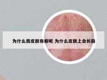 为什么我皮肤有癣呢 为什么皮肤上会长藓