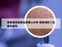 银屑病消退期还需要uvb吗 银屑病好了还要巩固吗