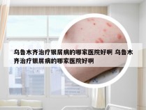 乌鲁木齐治疗银屑病的哪家医院好啊 乌鲁木齐治疗银屑病的哪家医院好啊