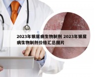 2023年银屑病生物制剂 2023年银屑病生物制剂价格汇总图片