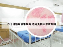 丹枙逍遥丸治牛皮癣 逍遥丸能治牛皮癣吗