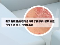 有没有银屑病妈妈遗传给了孩子的 银屑病遗传女儿还是儿子的几率大