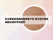 武汉看银屑病病的医院哪个好 武汉治疗银屑病最权威的专科医院