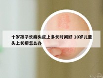 十岁孩子长癣头皮上多长时间好 10岁儿童头上长癣怎么办