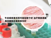 牛皮癣修美乐和可善挺哪个好 治疗银屑病是用可善挺还是修美乐好