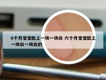 6个月宝宝脸上一块一块白 六个月宝宝脸上一块白一块白的